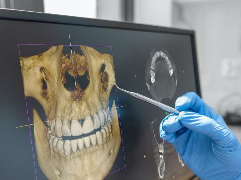 close up of CBCT dental image | 37221 dentist