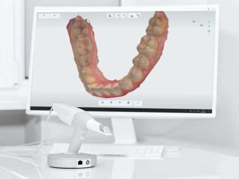 close up of digital impression | dentist office nashville tn